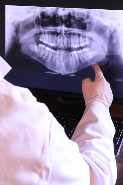 Best Emergency Root Canal Treatment in Mequon, WI