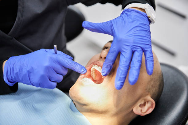 Best Emergency Dental Care for Broken or Chipped Teeth in Mequon, WI